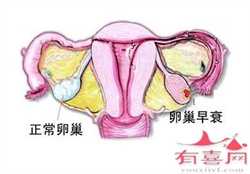 上海哪里有代孕，哪些人适合做上海第三代试管婴儿？